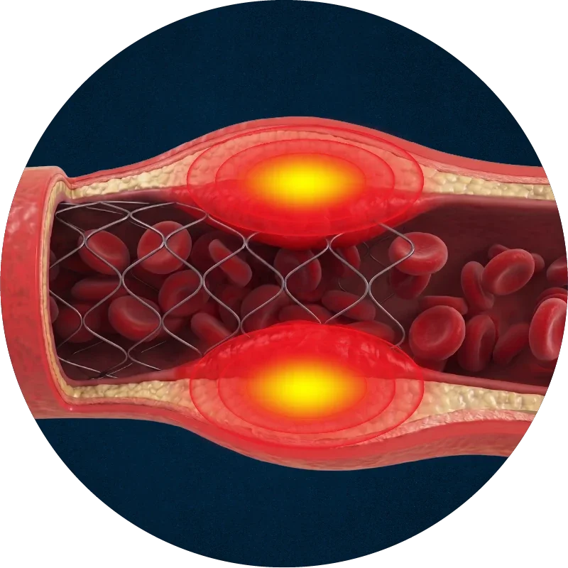 Vascular inflammation and tissue remodeling