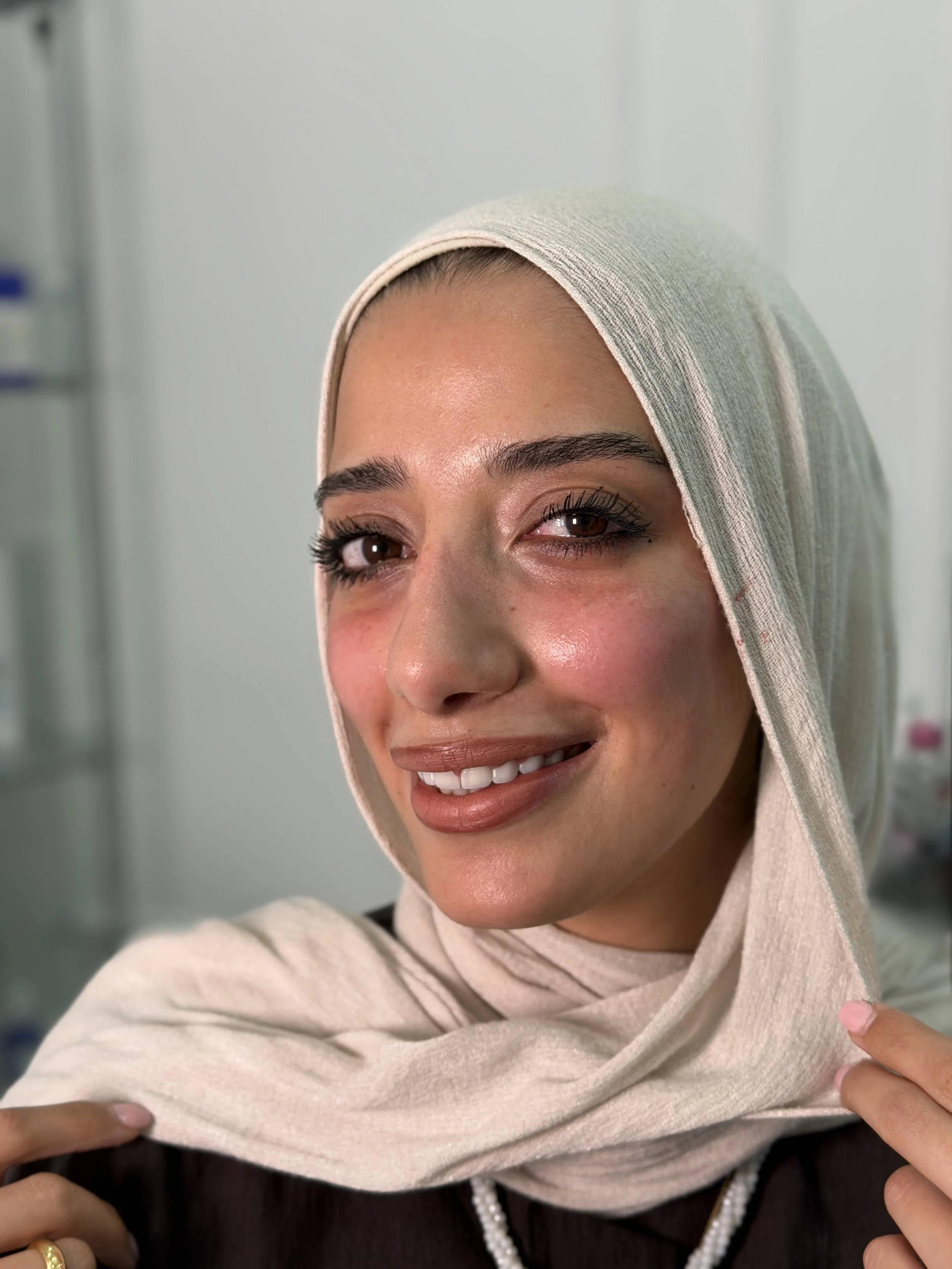 بعد — فيلر الخدين