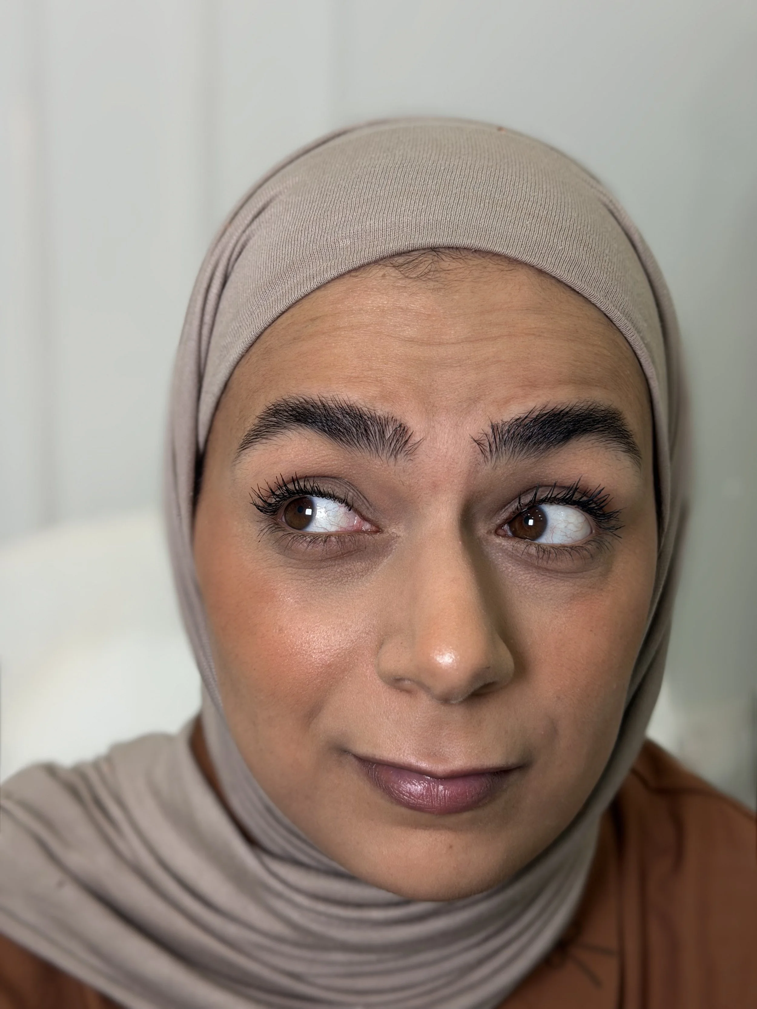 قبل — حقن مضادة للتجاعيد