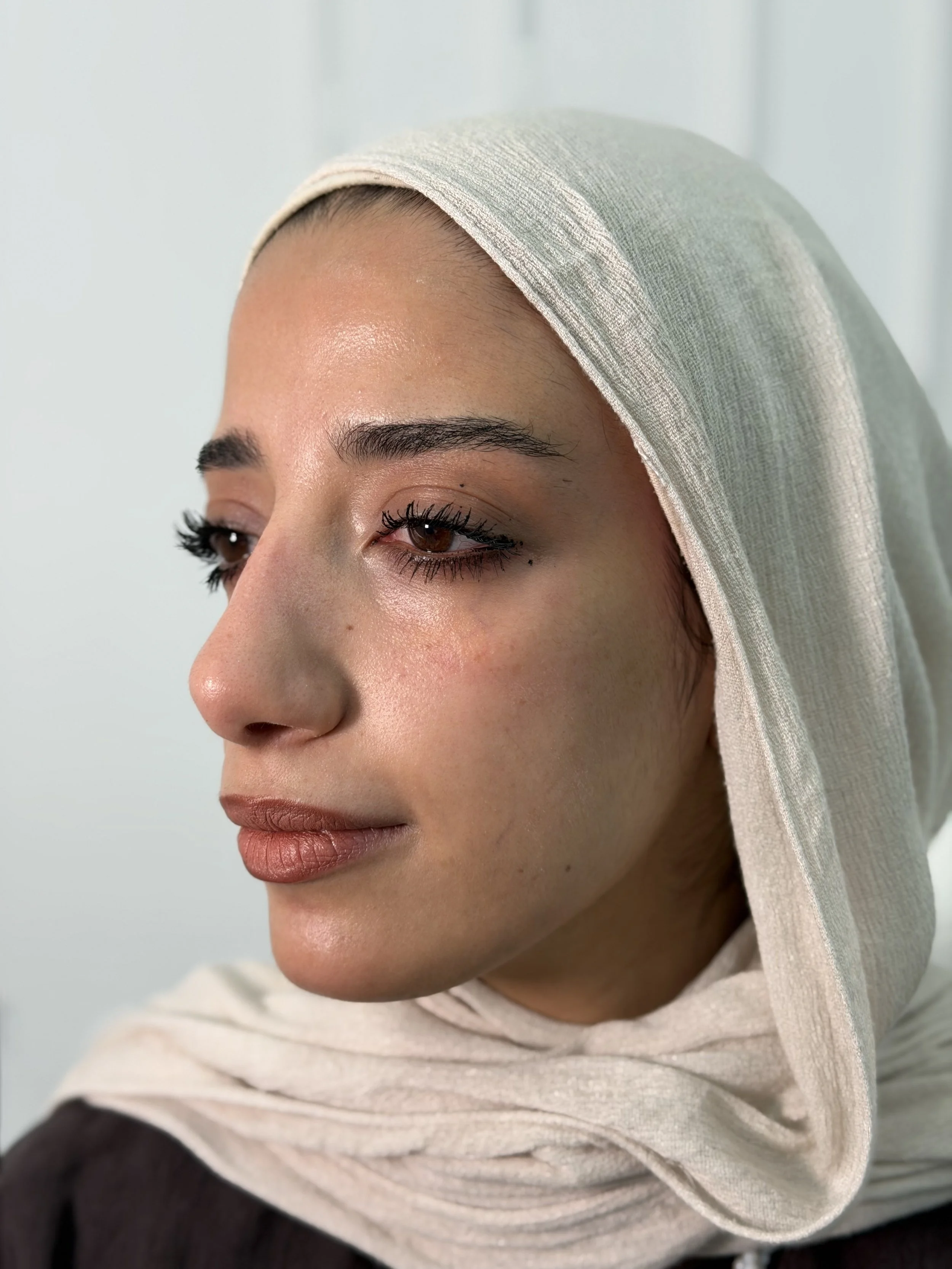 قبل — فيلر الخدين