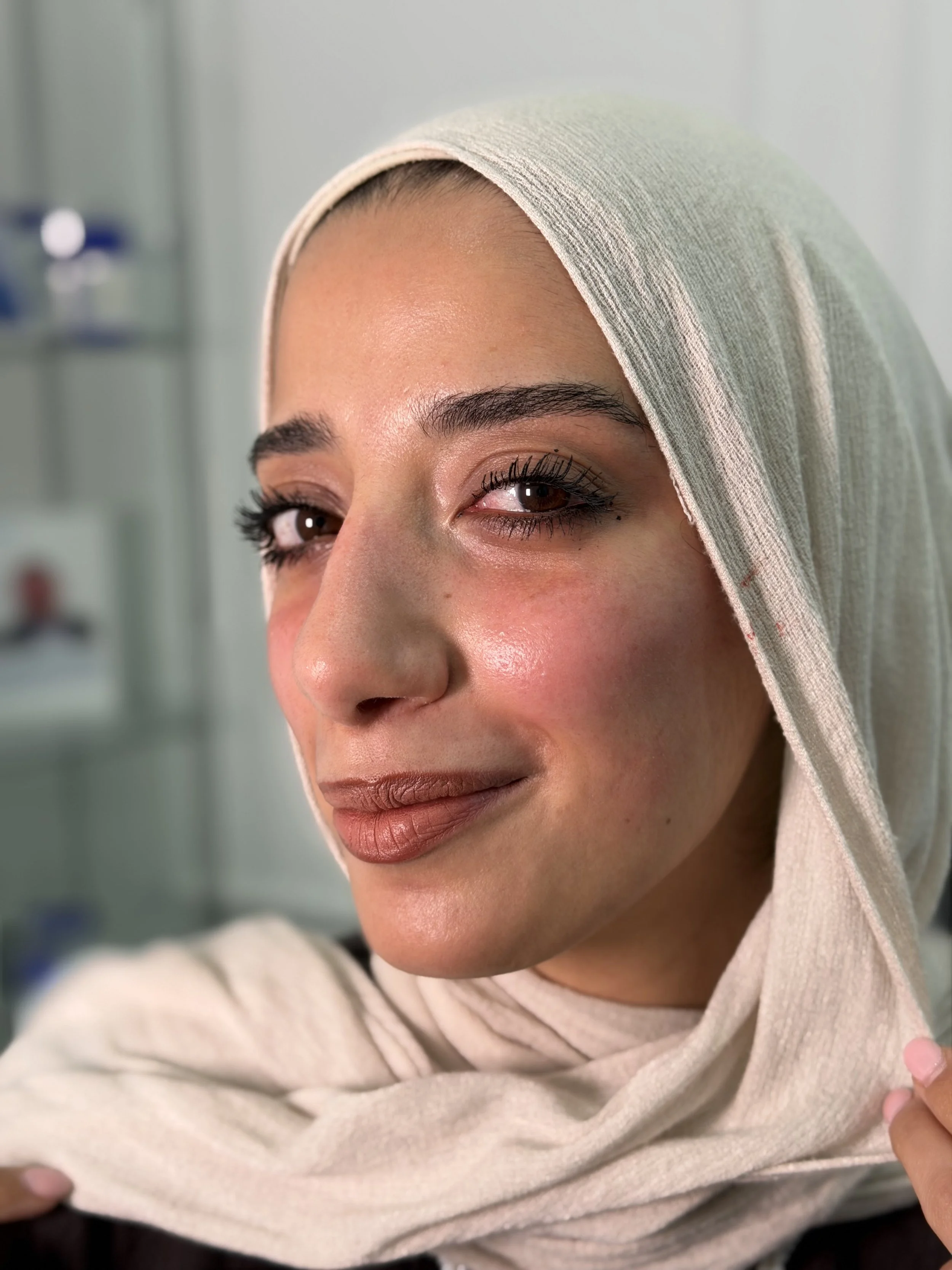 بعد — فيلر الخدين