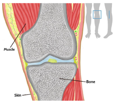 Scientific knee diagram used to interpret structures visible in a medical image