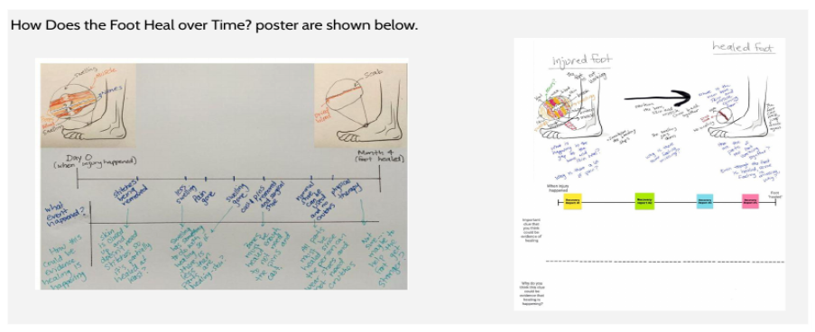 OpenSciEd examples of how the foot heals over time, including initial and healed foot models and a class timeline