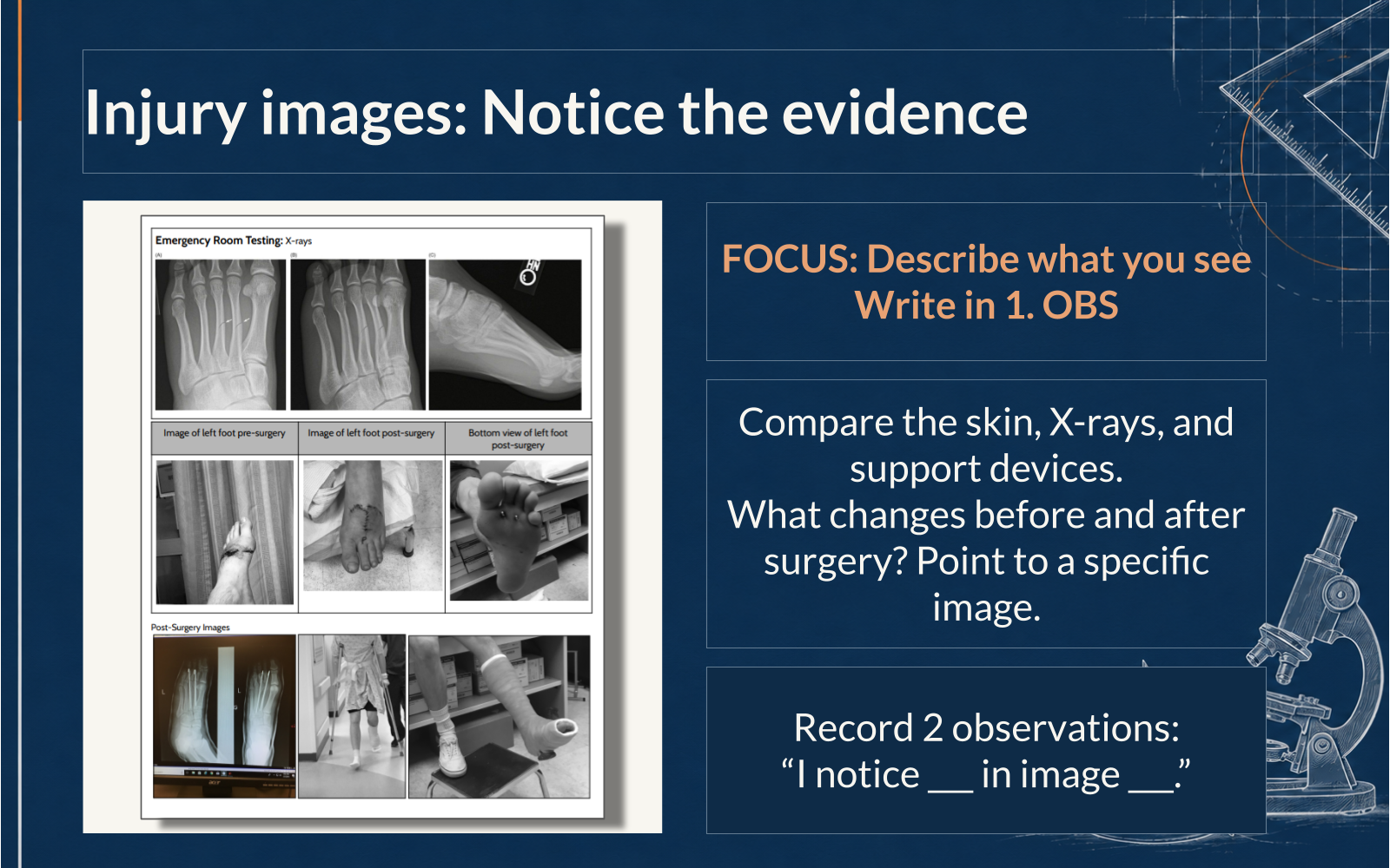 Slide directing students to compare skin, X-rays, and support devices and write I notice blank in image blank.