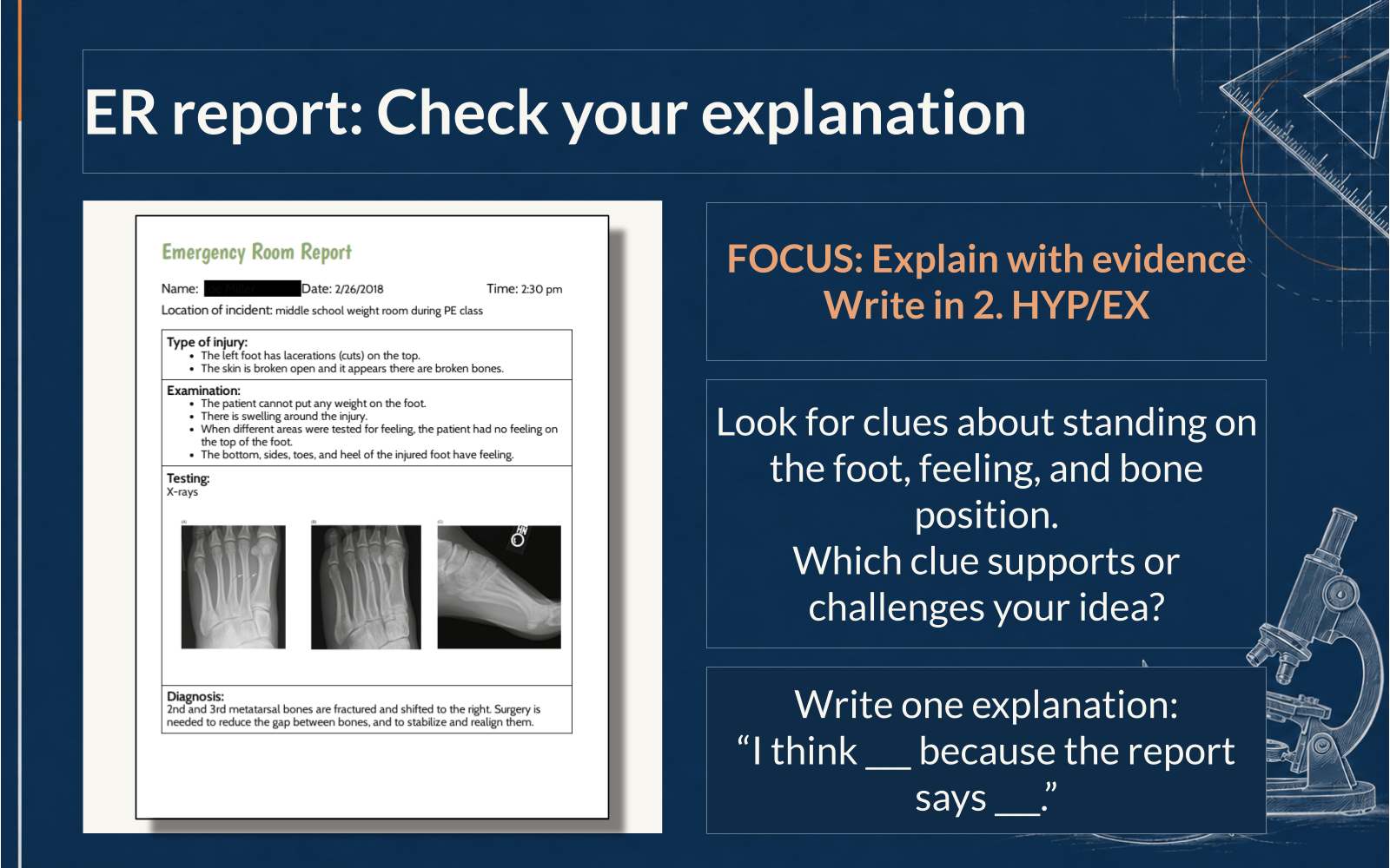 ER report slide with the frame I think blank because the report says blank and prompts about weight bearing, feeling, and bone position.