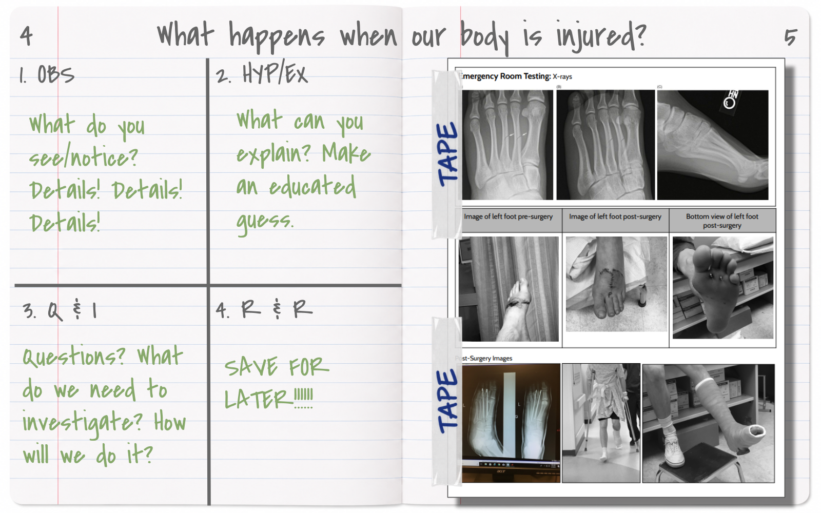 Injury lesson notebook slide with Observe, Hypothesize Explain, Question Investigate, and Revise Refine boxes beside foot photographs and X-rays.