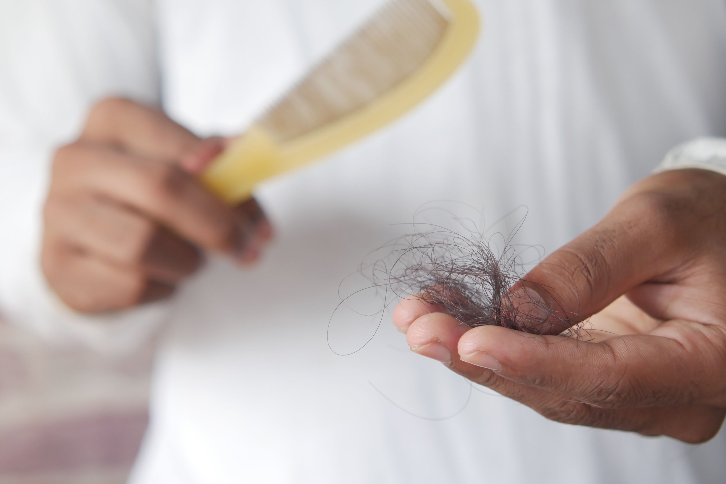Caída de pelo
