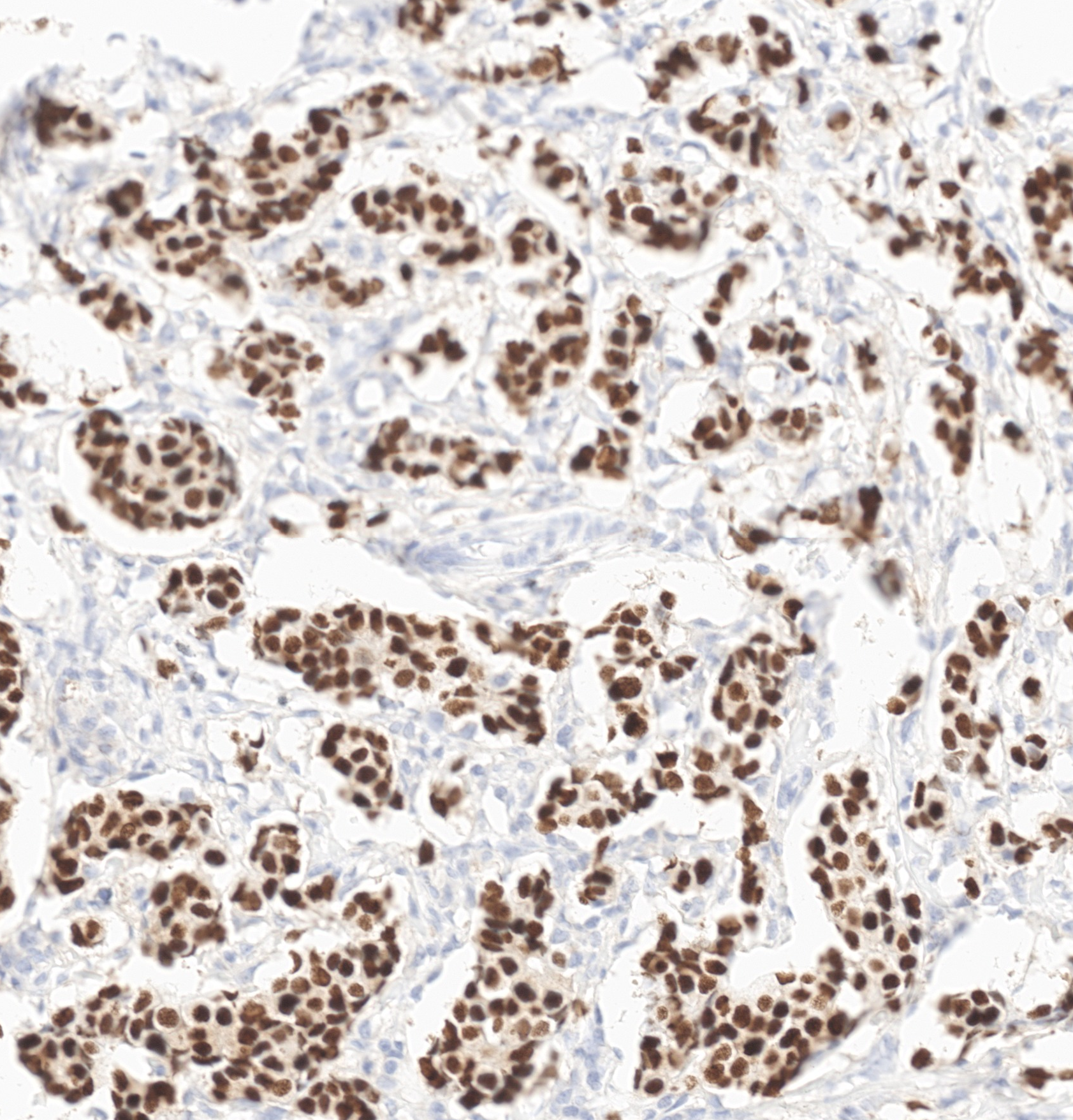 Physical IHC detail