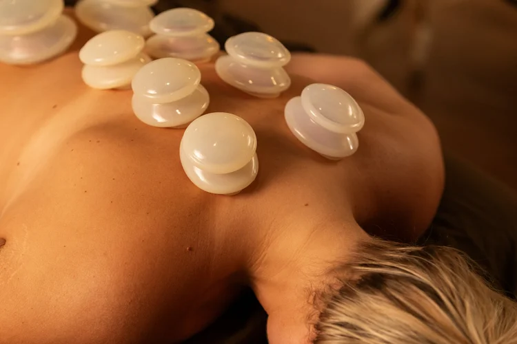 Silicone cups on a client's back during cupping massage