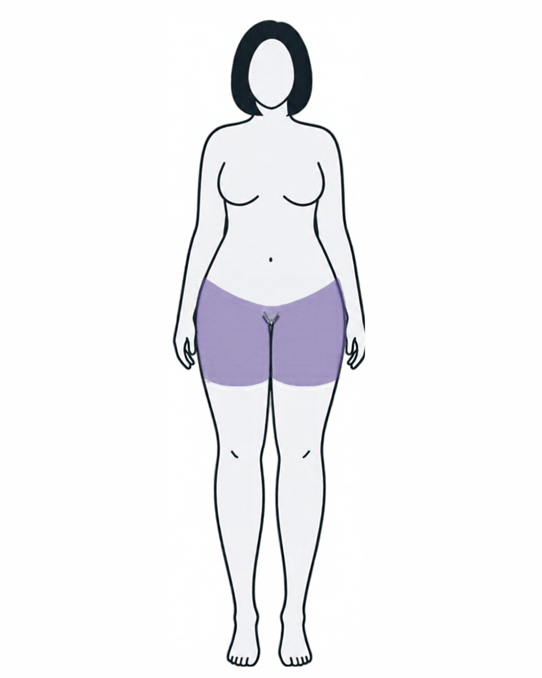 Lipedema Type I