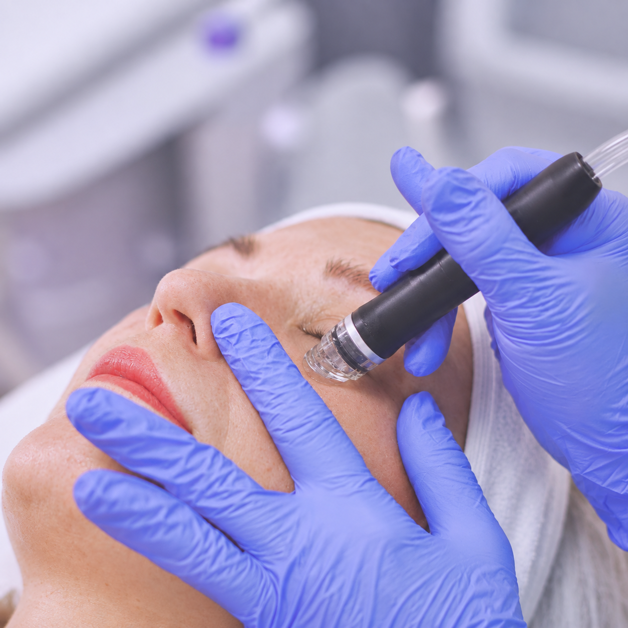 Hydrodermabrasion facial treatment