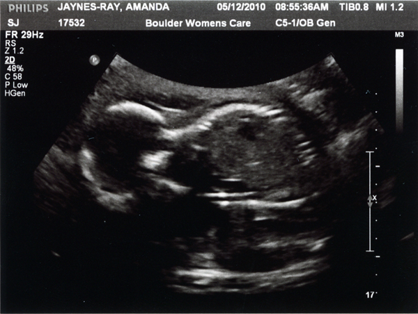 baby_boy_ray_01_sm.jpg