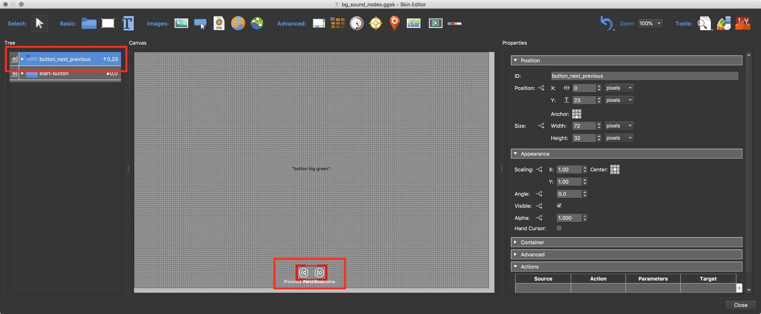 Figure #26: Next/Previous component added to the skin