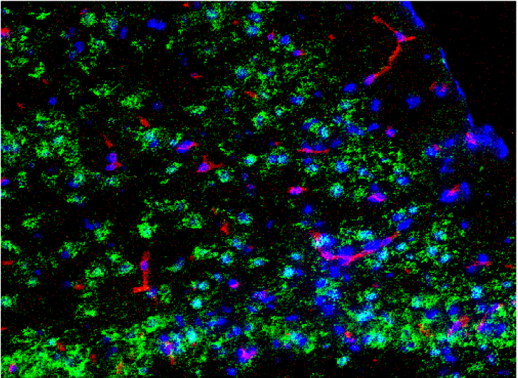 Virally infected CNS (sample provided by Thomas Ashhurst and Nicholas King)