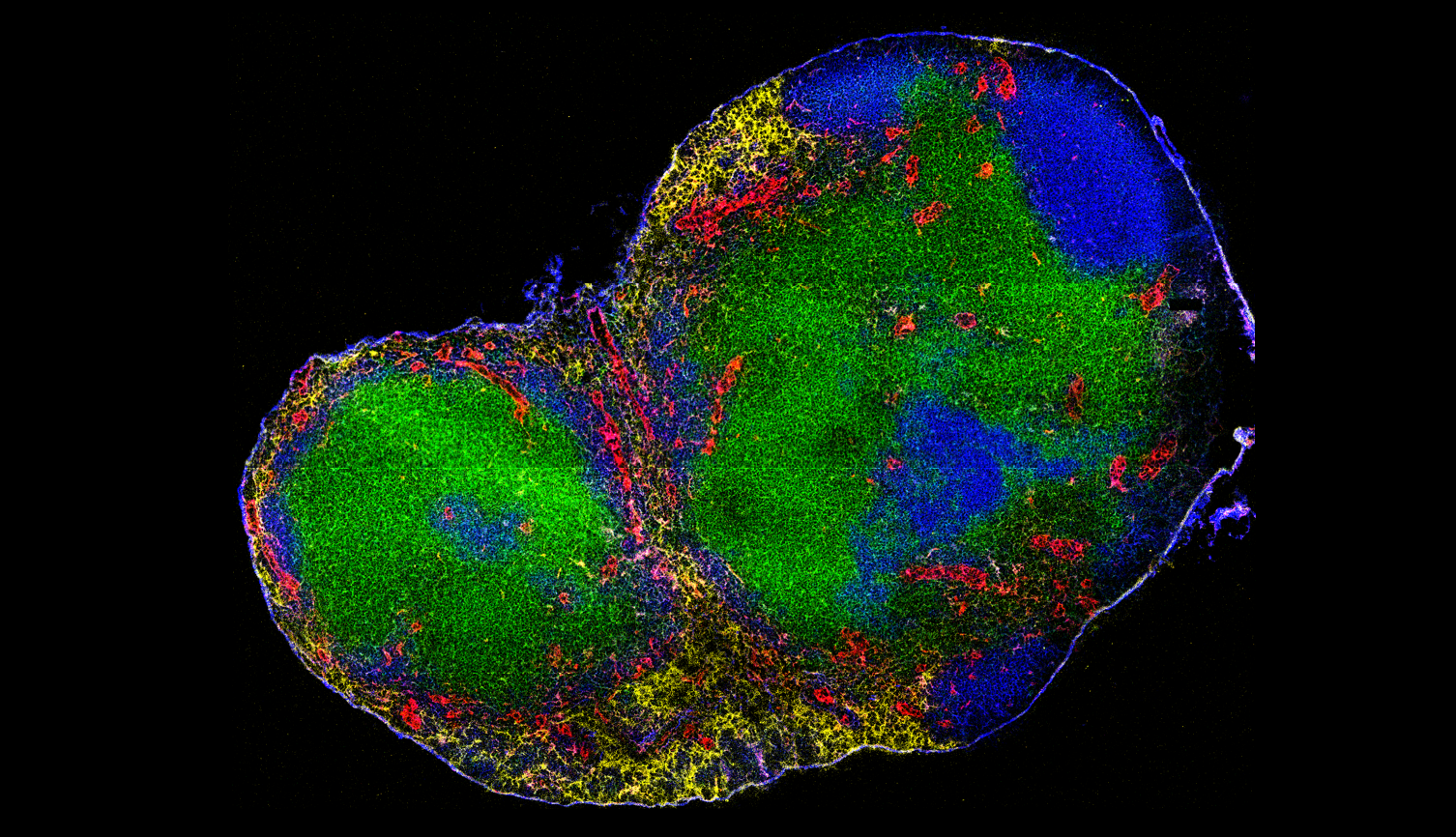 Mouse lymph node (sample provided by Benita Tse and Scott Byrne)