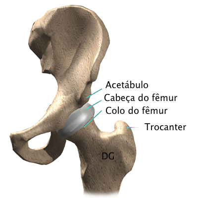 hip_avn_anatomy01.png