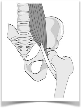 Ilustração representa o tendão do músculo psoas causando ressalto sobre a borda do acetábulo ou da cabeça femoral.