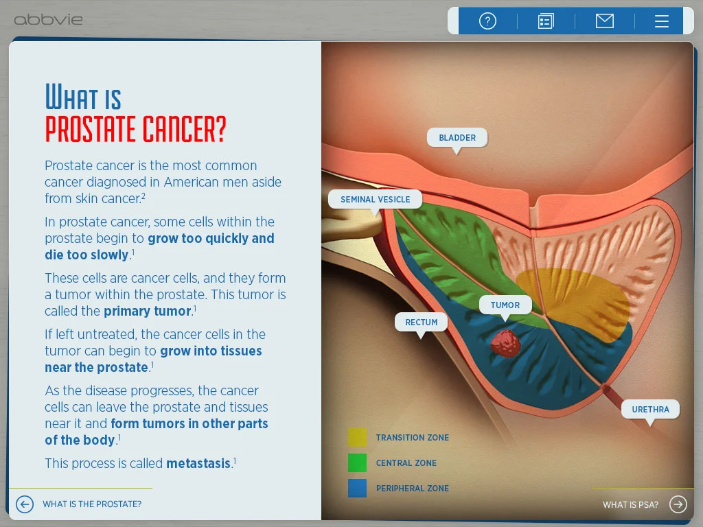 Prostate cancer education