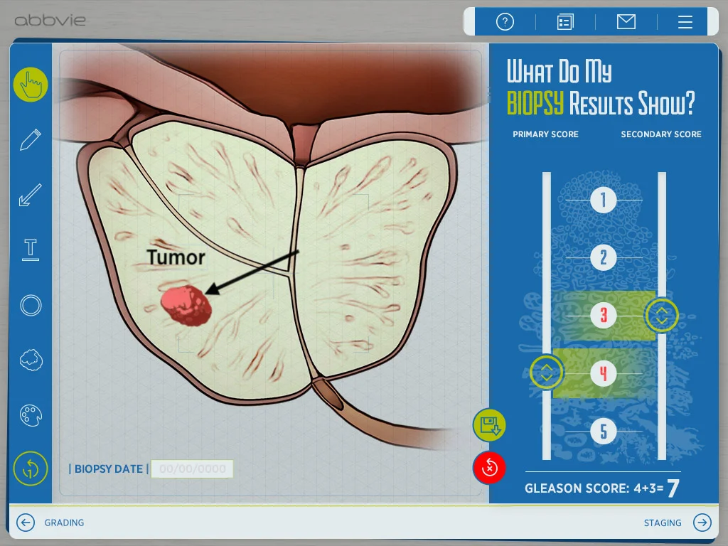 Biopsy results drawing tool