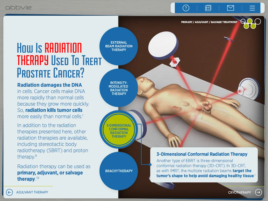 Prostate cancer treatment options
