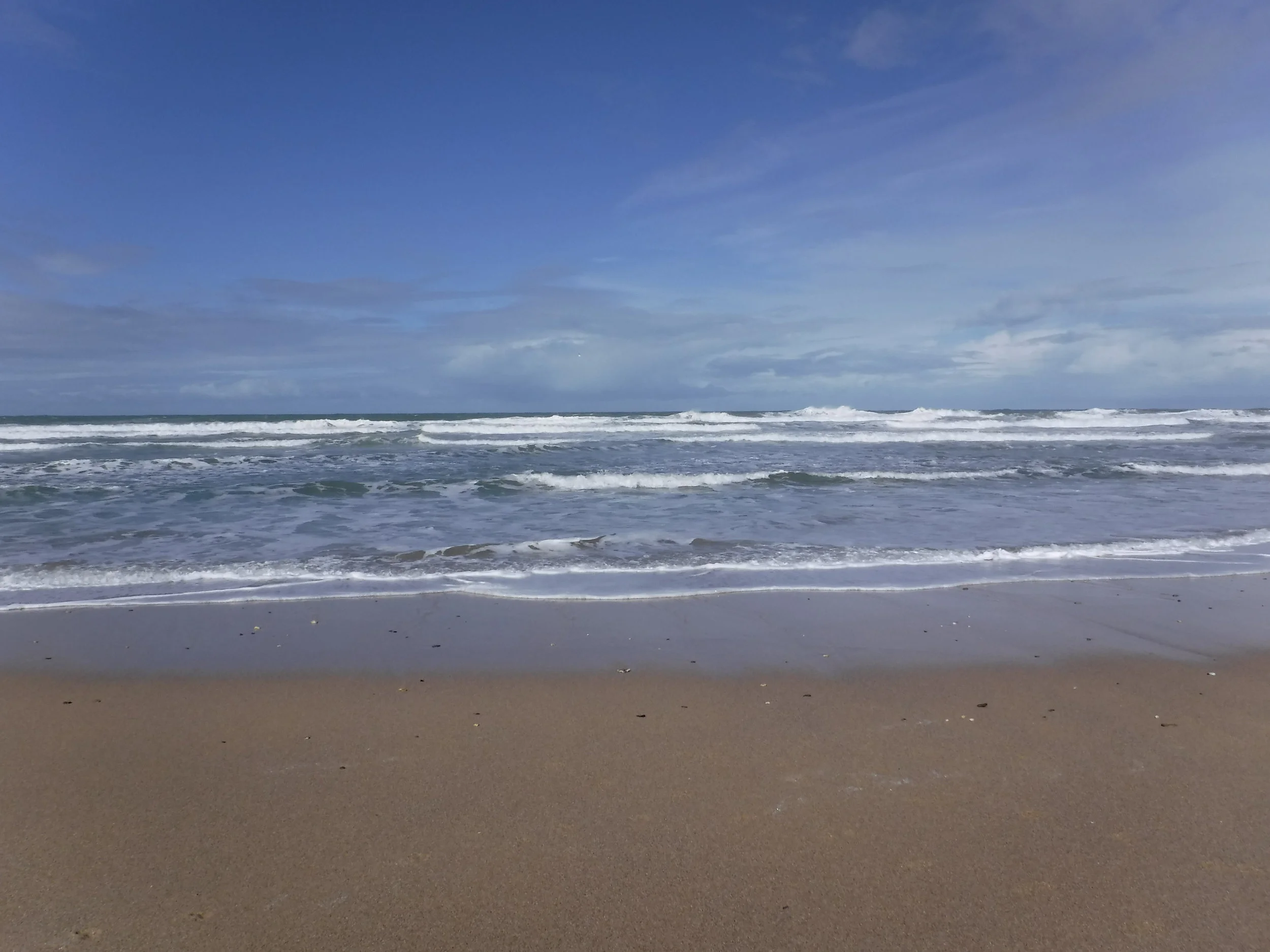 Stranded dolphins found to have amyloid plaque (a hallmark in humans of Alzheimer’s) in their brains