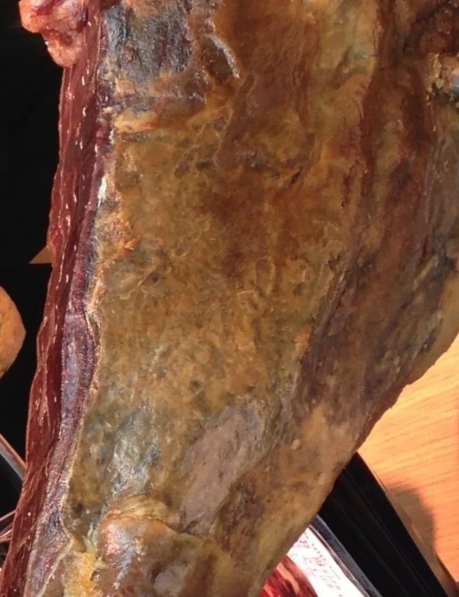 Eating red and processed meat associated with a higher risk of type 2 diabetes 