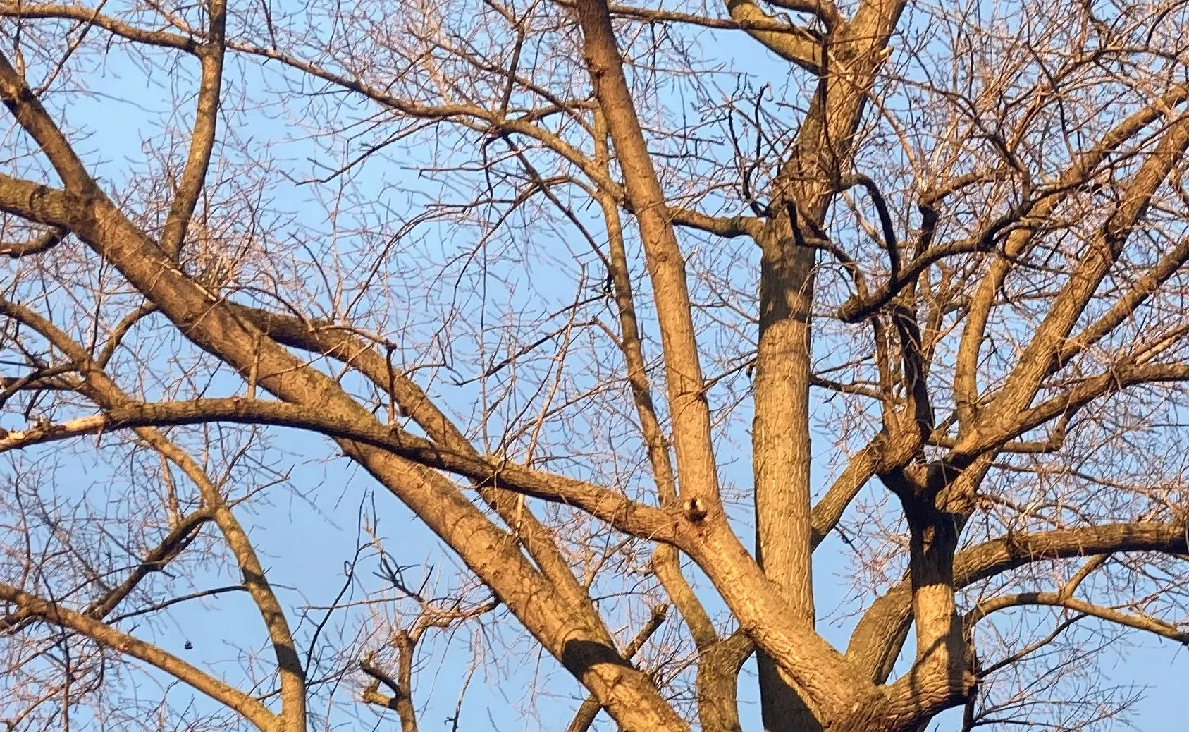 Poor vascular health linked to accelerated brain ageing