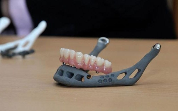 3D-Printed Lower Jaw Used In Jaw Transplant Surgery