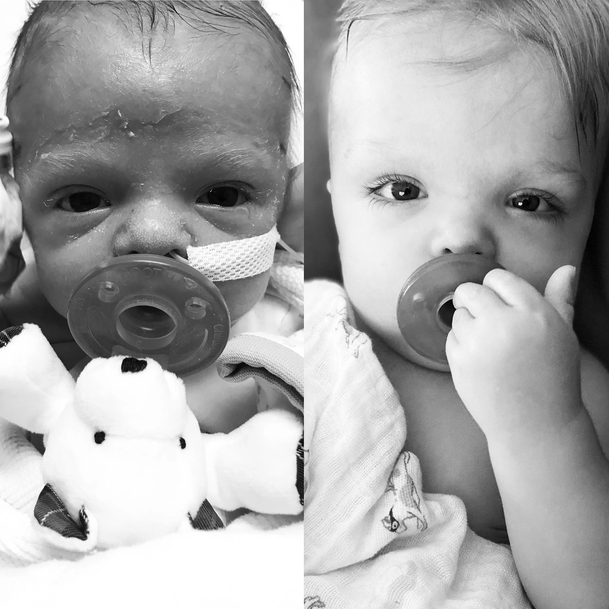 205 Multiple Sulfatase Deficiency with the United MSD Foundation — DNA Today