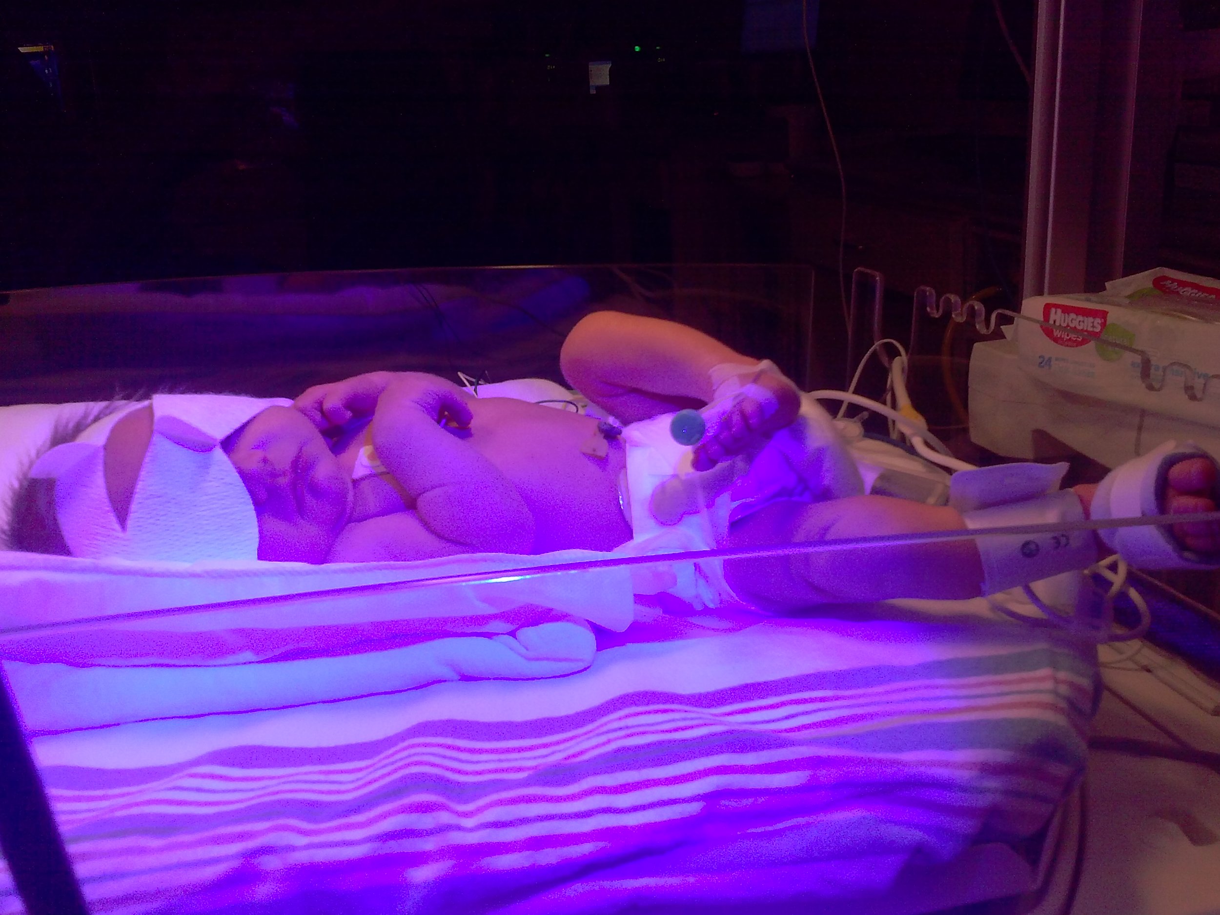 Emmett under bili-lights