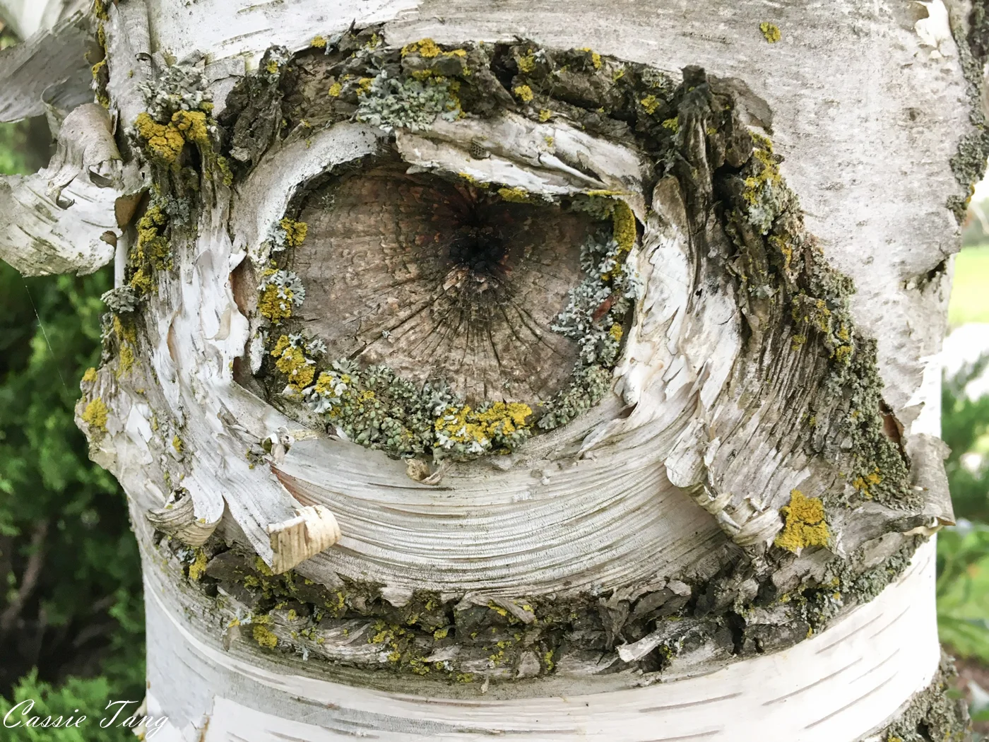 Eye