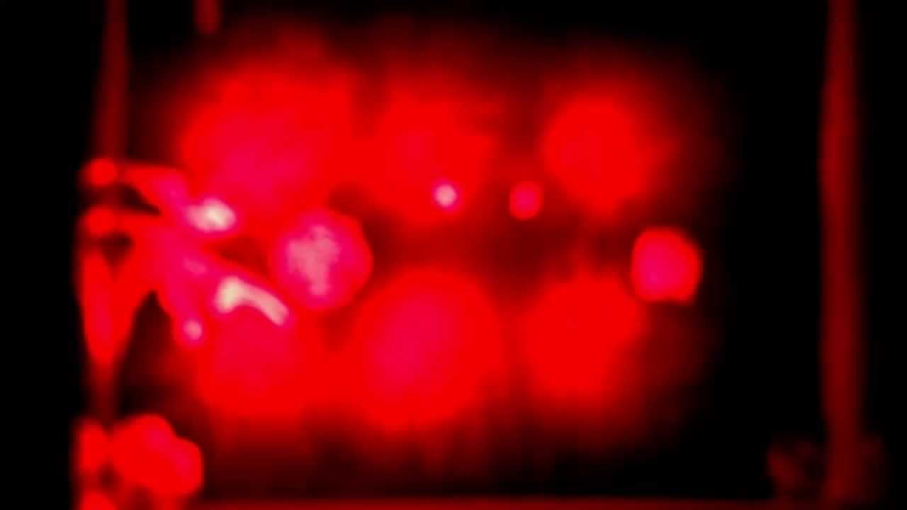 The R-Zone Zone: Episode 1