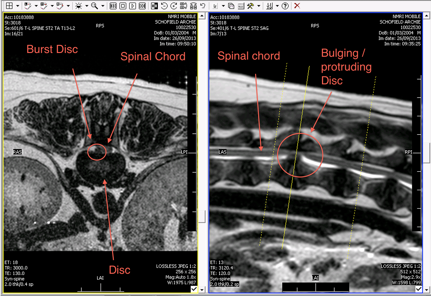 A closer view of the affected discs