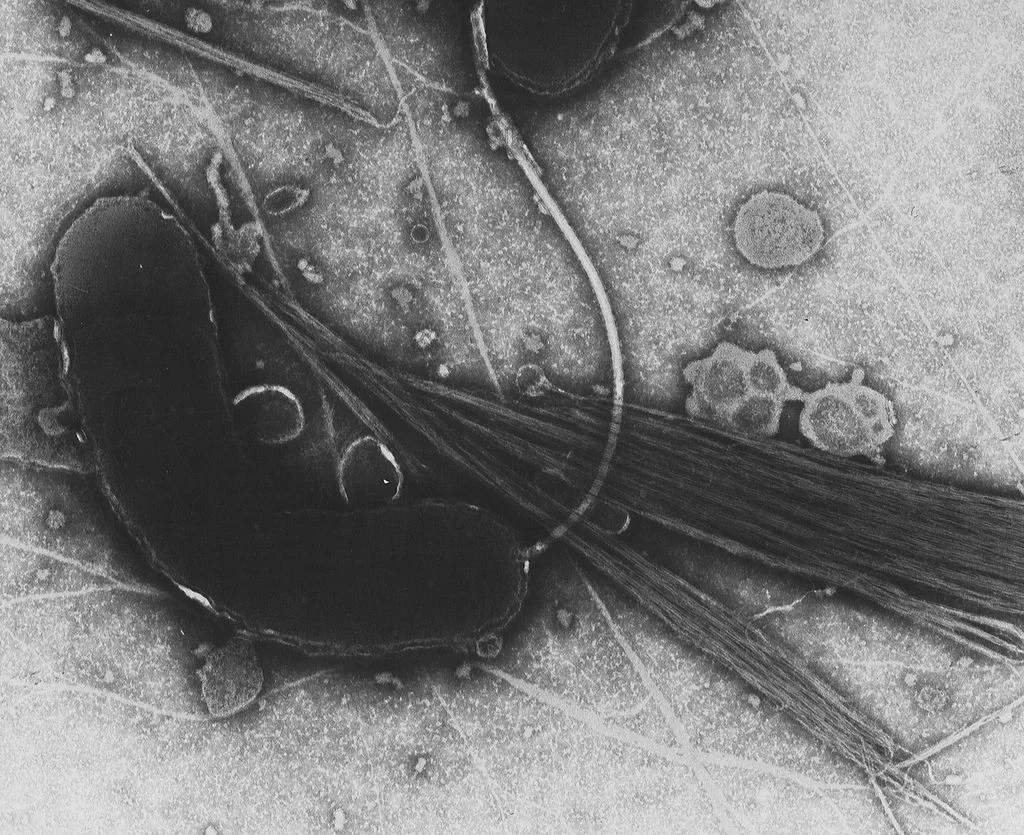 1024px-Vibrio_cholerae.jpg