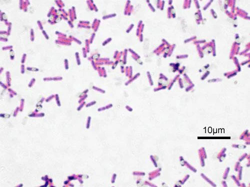 Bacillus_subtilis_Gram.jpg