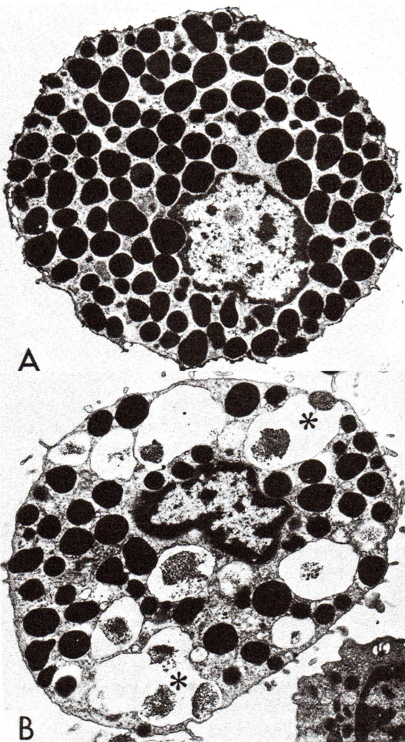 Image : Top: un-stimulated mast cell with its condensed quiescent granules. Bottom: stimulated mast cell with many activated decondensed granules.