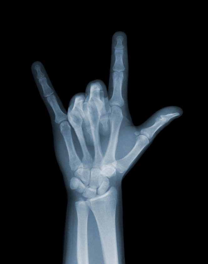 X-Ray-Photography-by-Nick-Veasey-feeldesain-03.png