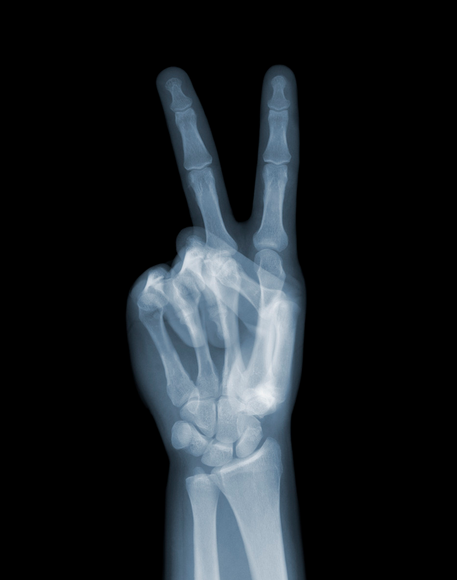 X-Ray-Photography-by-Nick-Veasey-feeldesain-02.png