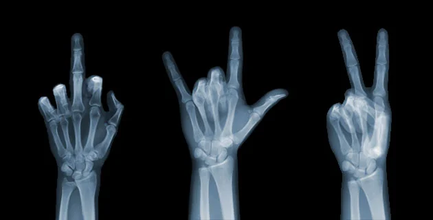 X-Ray Camera Shots