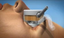 Ep 22 Talking About Glaucoma - 6Feb2014: HiFU Therapy (AAC Enhanced)