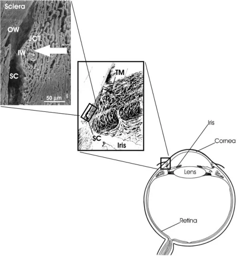 Ep 23 Talking About Glaucoma - 3Nov2014: ab-interno trabecular bypass surgery (AAC Enhanced)