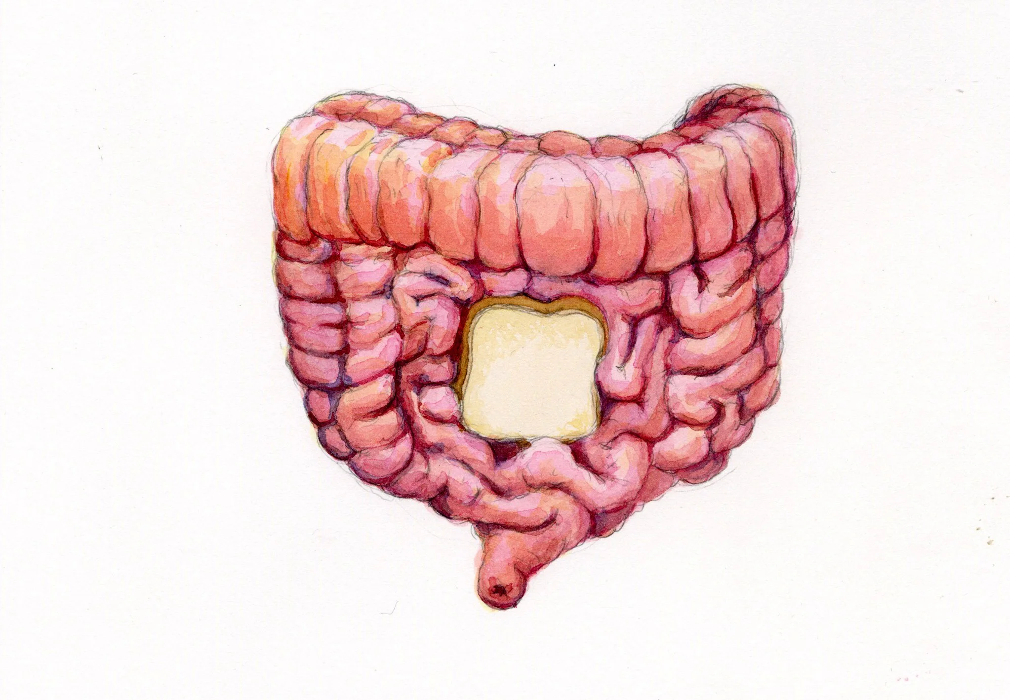 Words: Celiac disease
