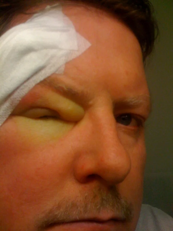 eye2.jpg