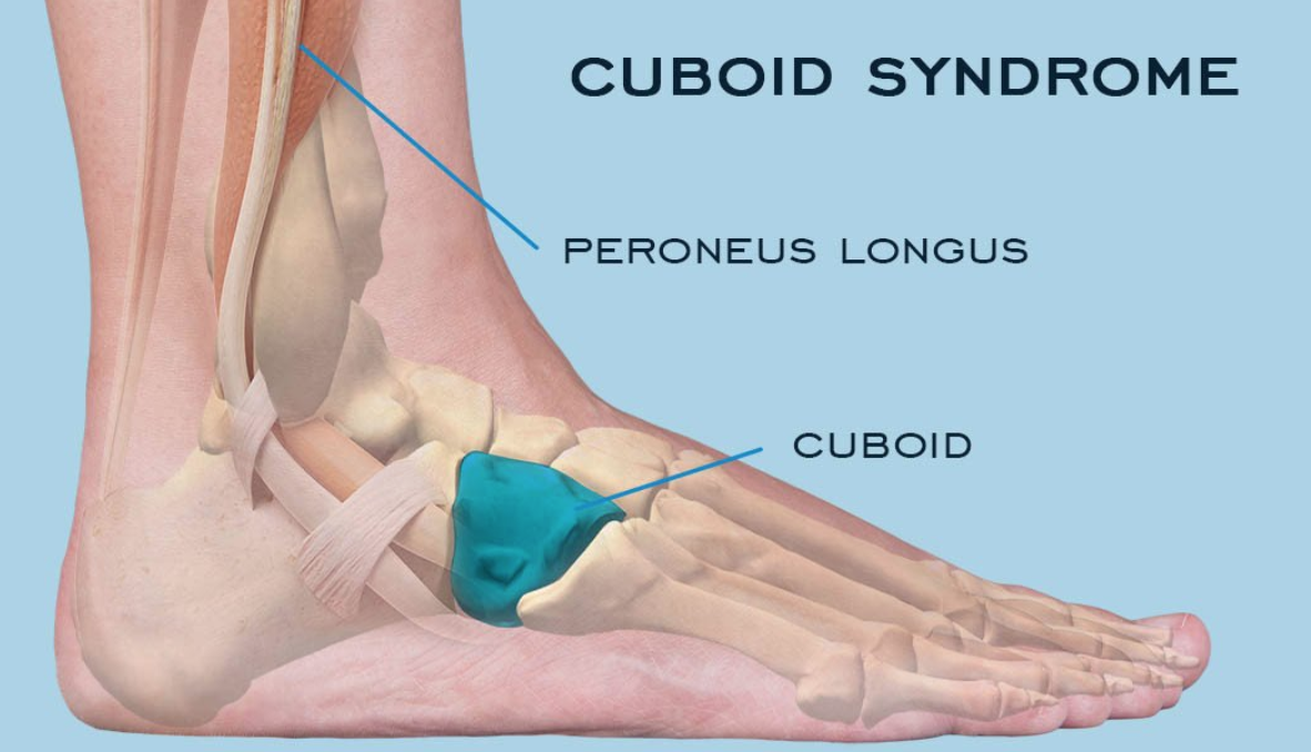 pain outside of heel below ankle