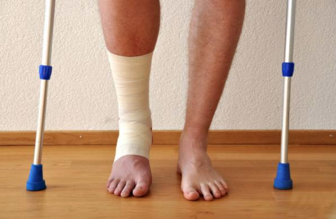 Recovering From An Ankle Sprain Max Remedial Massage And Therapy