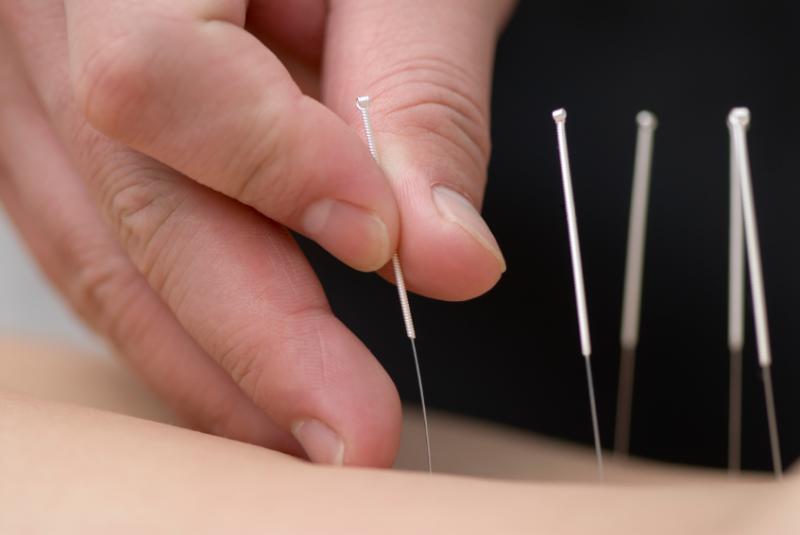 acupuncture110324104147-large.jpg