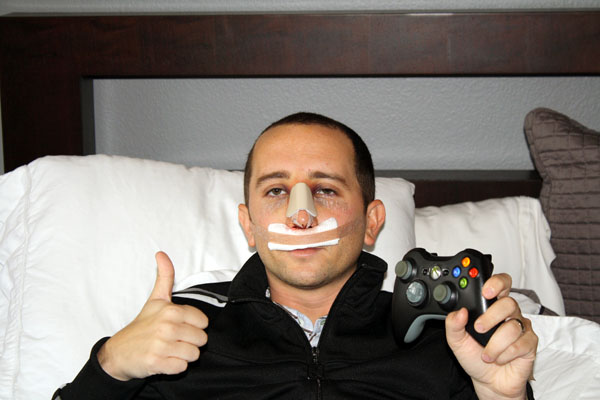 rhinoplasty.jpg