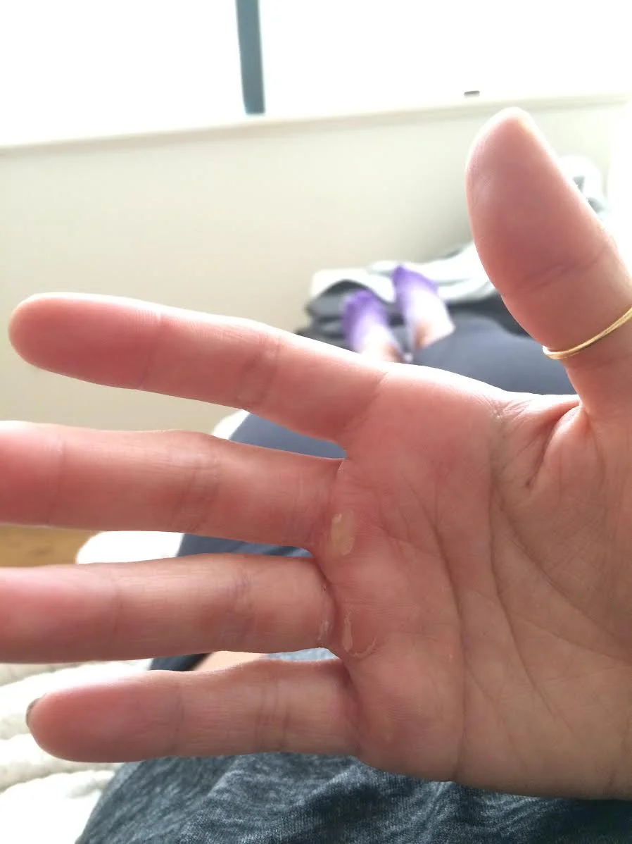 Woof, the calluses