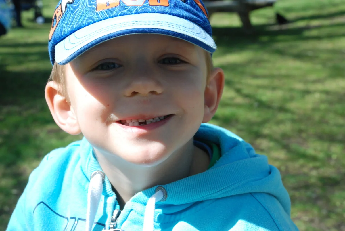 1 less tooth