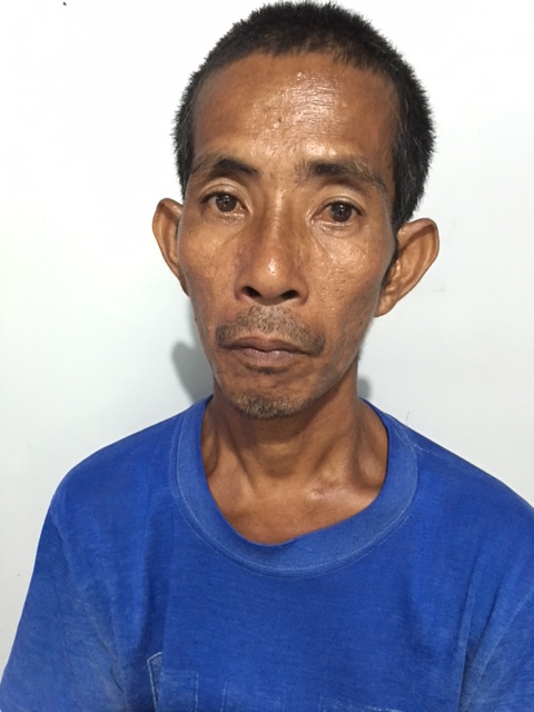 This 44-year-old man had his eyes checked and was sent out for pterygium removal surgery. 
